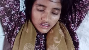 জমিজমা বিরোধে  প্রতিবন্ধী কিশোরীকে হাতুড়ি পেটা