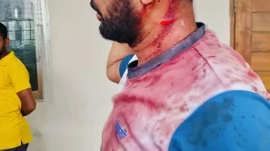 বরিশালের চাদঁপুরায় জমি নিয়ে বিরোধ, মৎস্যজীবী দল নেতা আলিম সরদার আহত